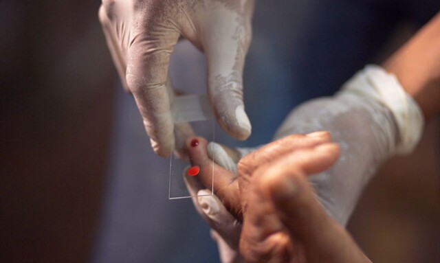 Notícias de Rondônia - Ministério da Saúde quer zerar casos de malária no país até 2035